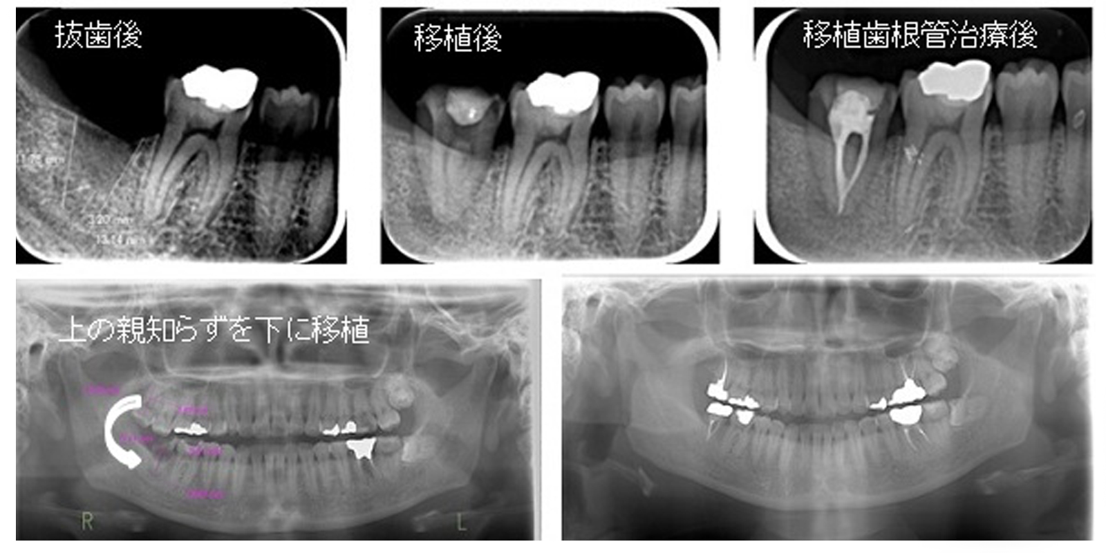 全体的な治療